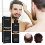 Champú anticaída activador de raíz